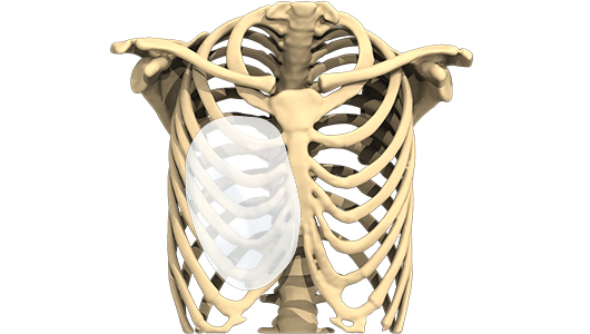 Vista 3D de un implante para tratar un tórax en embudo