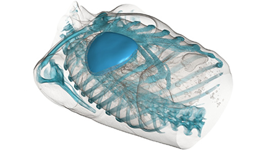 Sindrome di Poland : La tecnica degli impianti 3D su mesura