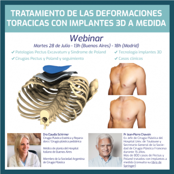 Webinar tratamiento del Pectus - 28 de Julio